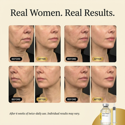 Avelune SilkThread Ampoule